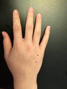 Acupressure Points for Lower Back Pain