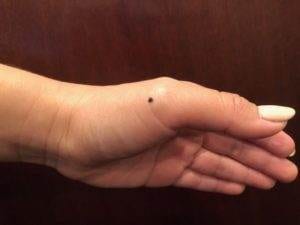 Acupressure point for sprained ankle