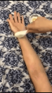 Gua Sha on inner arm