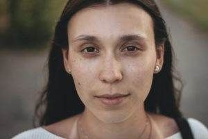 acupuncture face lift