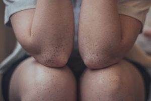 elbow knee