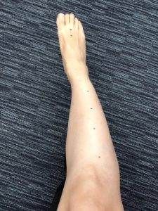 stomach meridian acupressure points