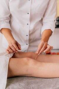 Acupuncture Rheumatoid Arthritis
