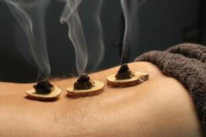 moxibustion TCM treatment