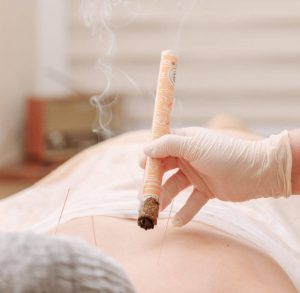 moxibustion moxa treatment