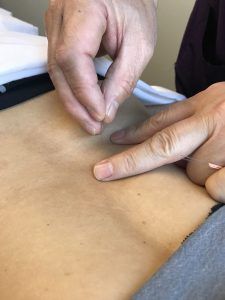 acupuncture treatment for diarrhea IBS IBD