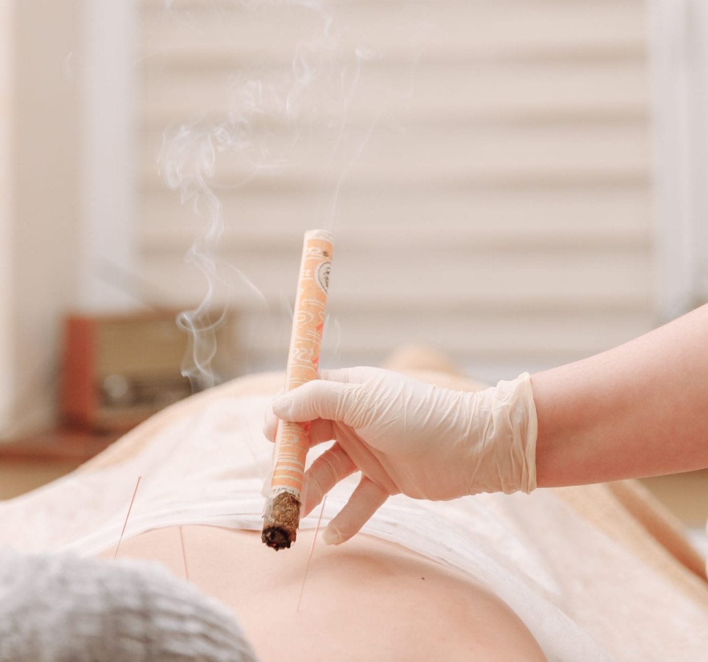 moxibustion treatment