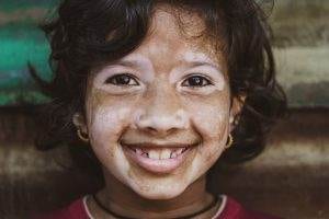 vitiligo in childhood