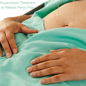 pelvic congestion syndrome