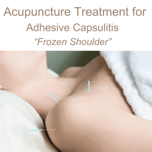 Acupuncture treatment for frozen shoulder