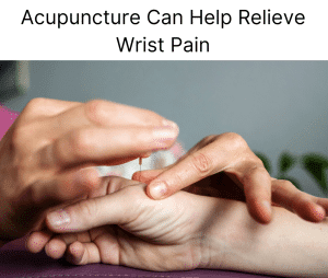acupuncture needling on thumb side of wrist