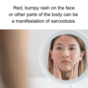 red bumpy rash on face 