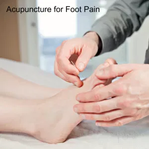 acupuncture treatment for plantar fasciosis