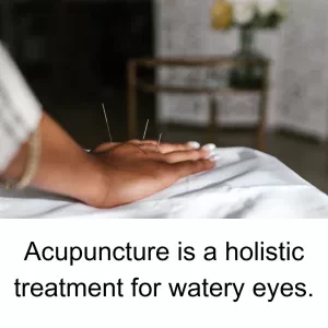TCM treatment for watery eyes includes acupuncture, herbs, and nutrition.