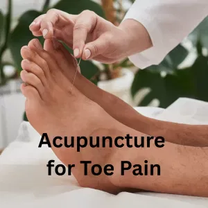 acupuncture treatment for turf toe pain