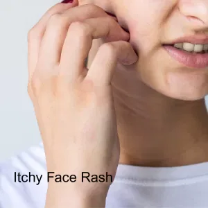 Itchy red bumps on face