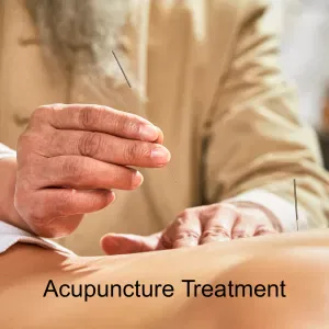 Acupuncture treatment for nutcracker syndrome