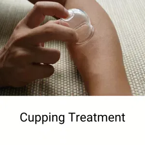 cupping treatment for Dupuytren's Contracture