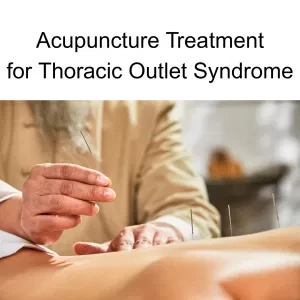 acupuncturist placing needles in a person's upper back