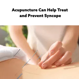 woman's hands placing acupuncture needles in a patient's back
