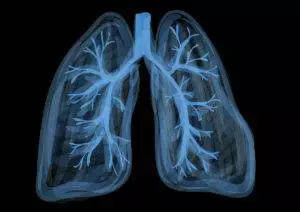 lungs cystic fibrosis