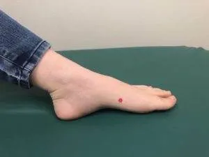 Spleen 4 acupressure point