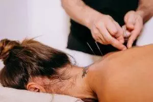 acupuncture epileptic seizures