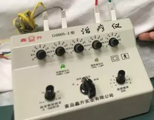 electroacupuncture electro-stim