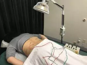 electro acupuncture