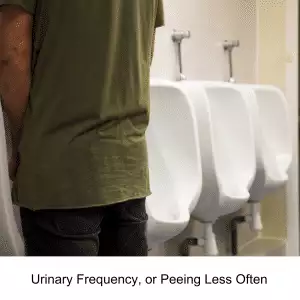 CKD - peeing more often or less often