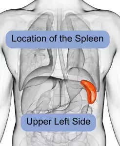 enlarged spleen