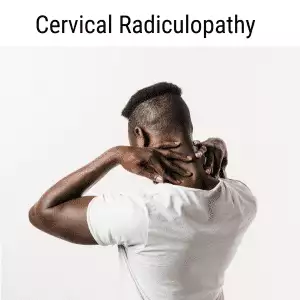 Cervical radiculopathy is usually caused by nerve compression.