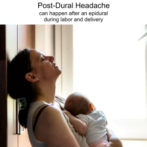 Post dural headache can happen after an epidural or spinal tap 