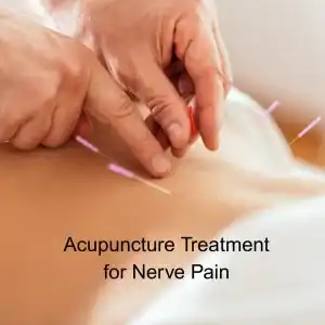 acupuncture needles
