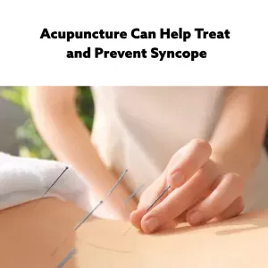 woman's hands placing acupuncture needles in a patient's back
