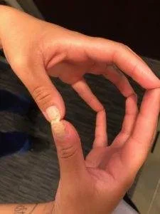 stimulating the fingertips