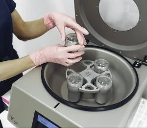 plasmapheresis plasma exchange