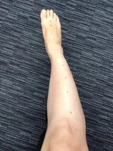 stomach meridian acupressure points
