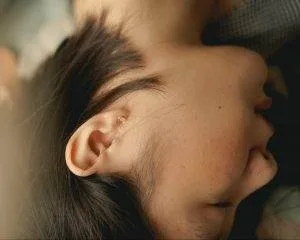 Meniere's dizziness vertigo hearing loss