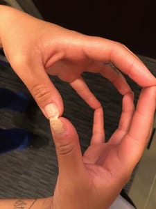 stimulating the fingertips