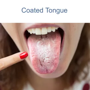 A coated tongue can go along with having bad breath.