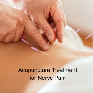 acupuncture needles