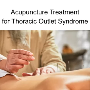 acupuncturist placing needles in a person's upper back