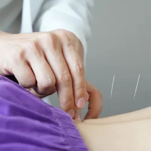 acupuncture for hip pain